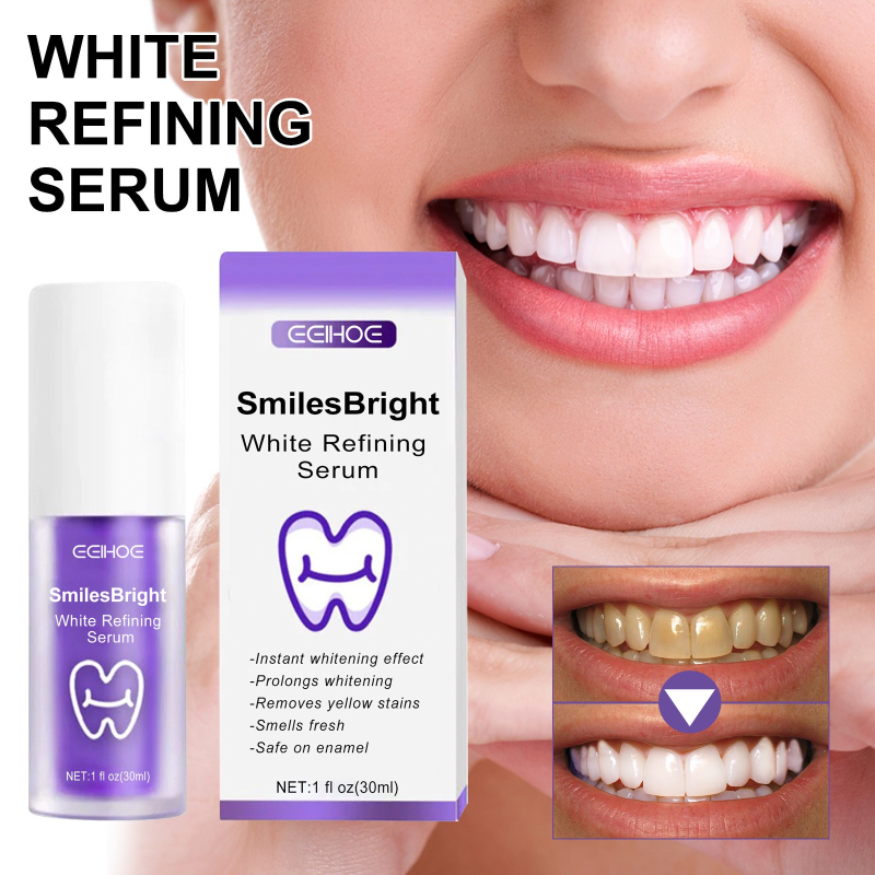 Teeth Whitening Korea - Zahnreinigung, Aufhellung, Zahnpasta, Aufhellung, Gel, Aufheller,