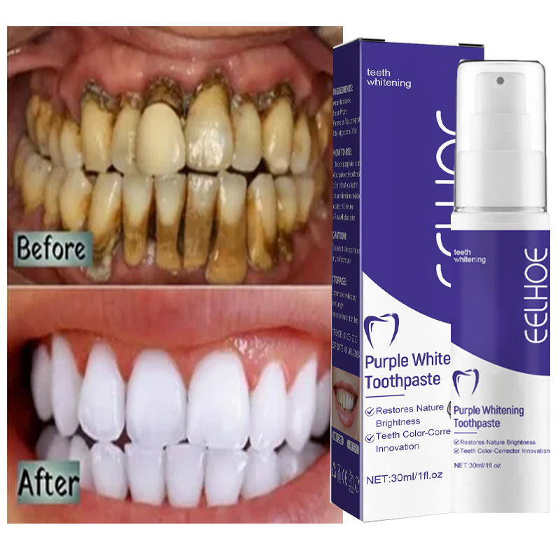 Teeth Whitening Korea - 1 stücke Zahn reinigung White ning