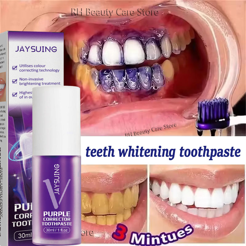 Teeth Whitening Korea - Zahnreinigungs- und Aufhellungs-Zahnpasta, Aufhellungsgel, Bleichmittel, entfernt