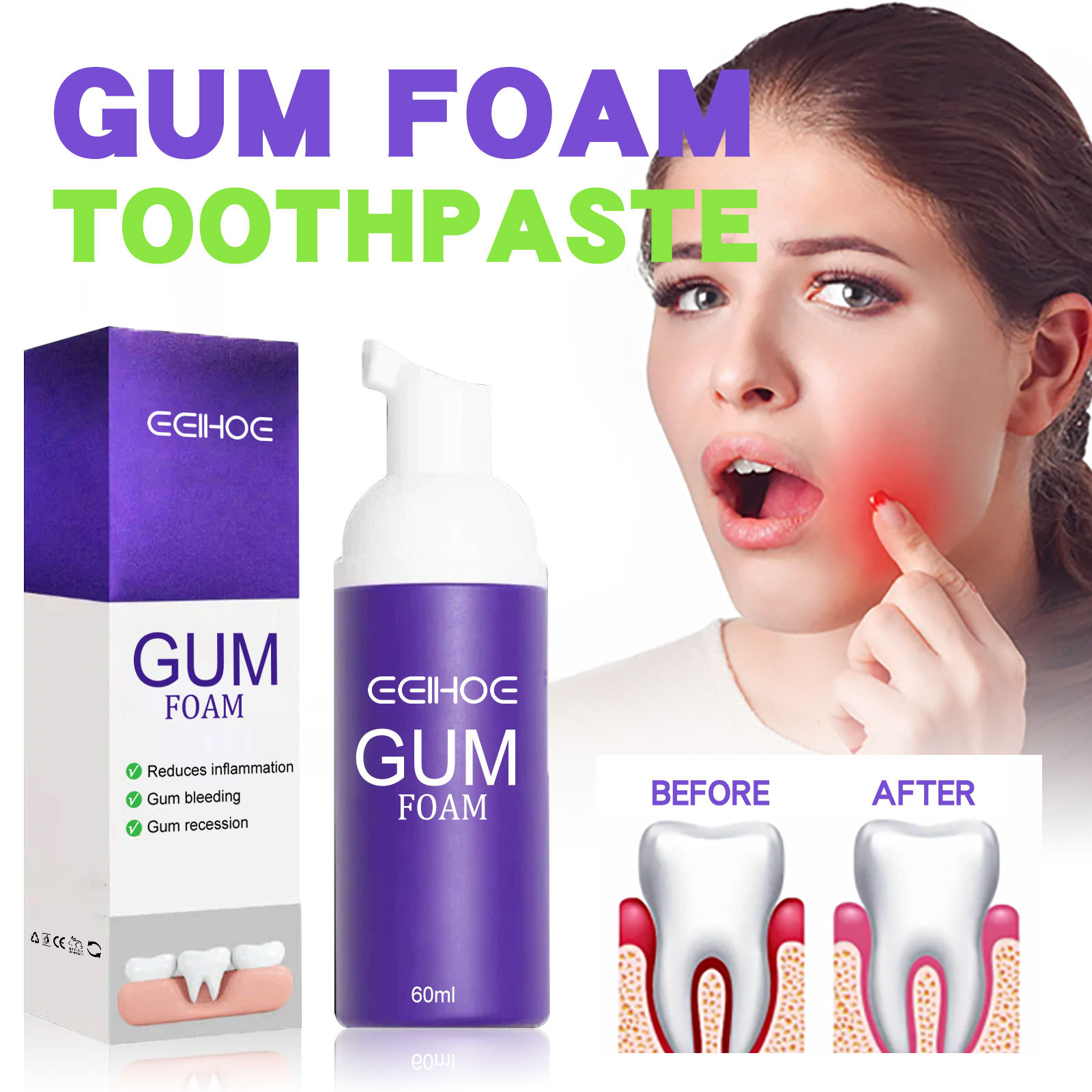 Teeth Whitening Best - 60 ml Zahnaufhellungsmousse V34 Zahnreinigung Aufhellende