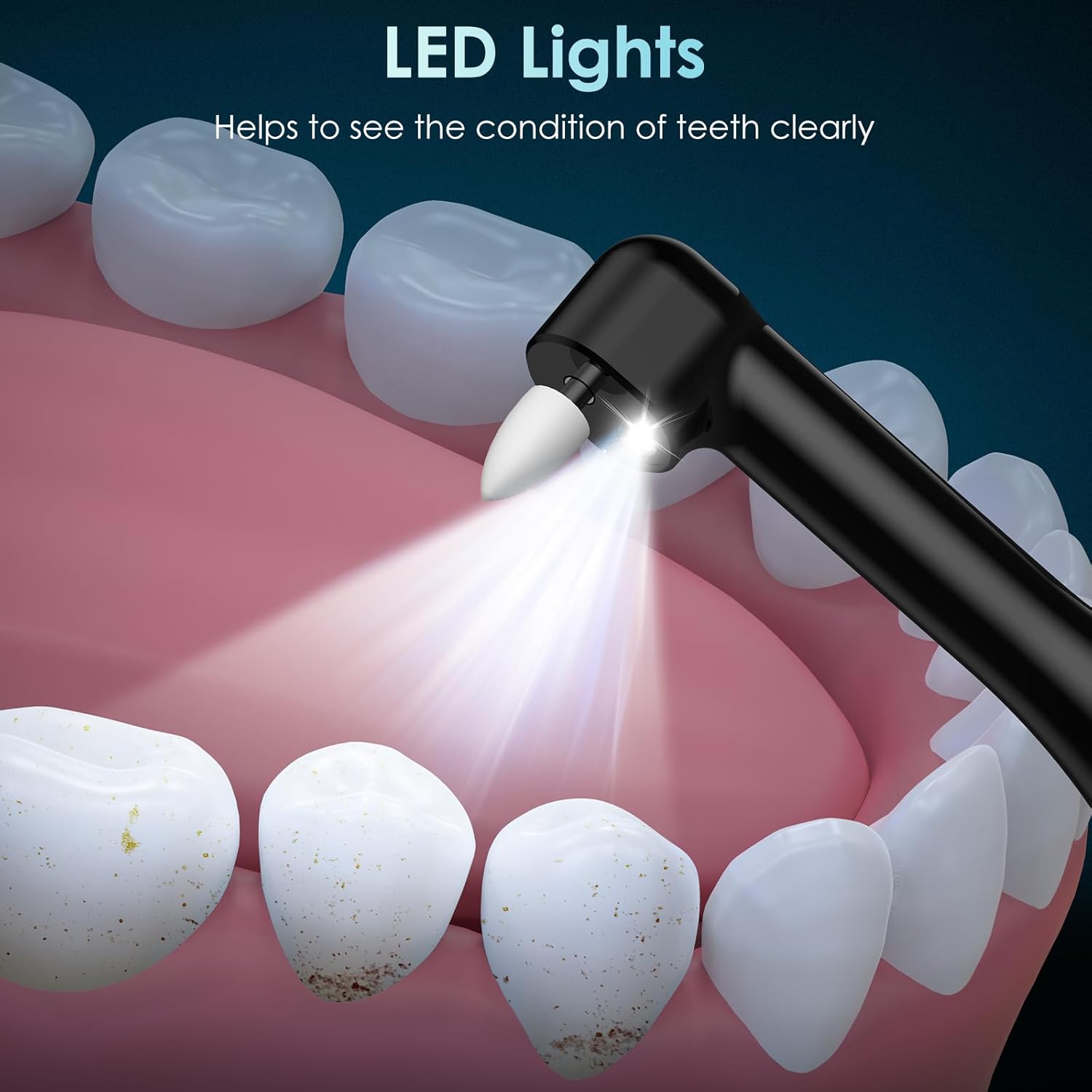 Zahnpolierer, wiederaufladbare – Teeth Whitening Or Tooth Whitening Bewertung und Preis