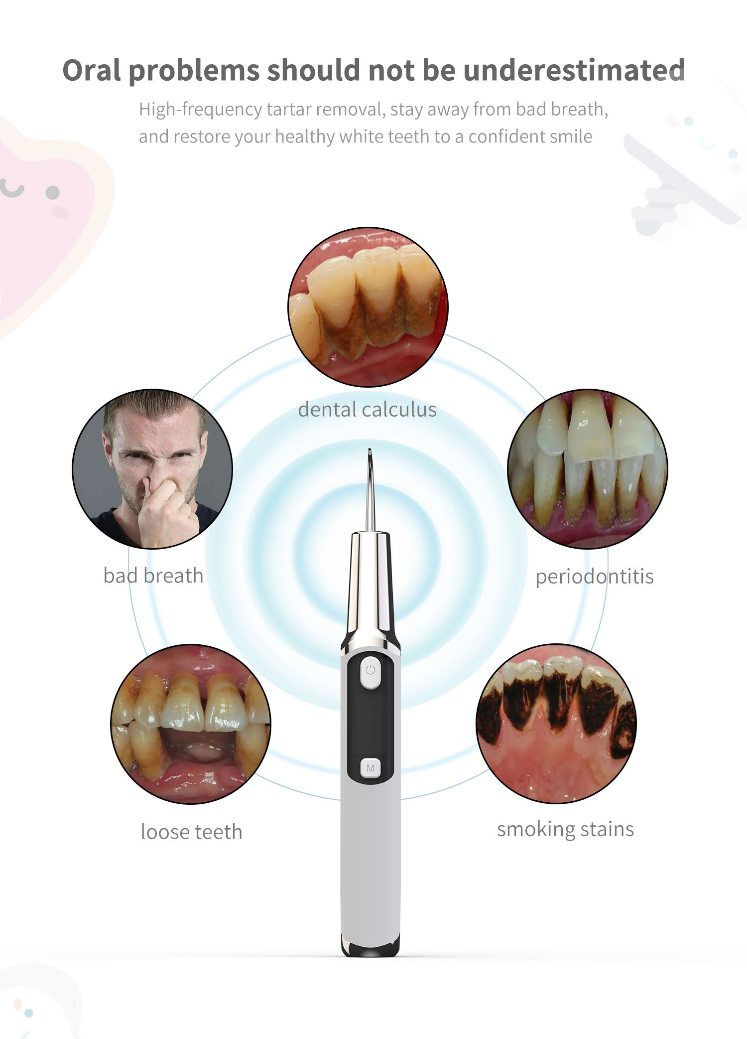 Elektrische Sonic Zahnstein Sc – Teeth Whitening Or Tooth Whitening Bewertung und Preis