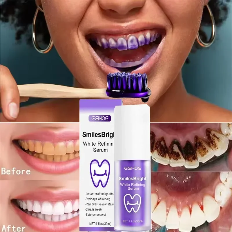 Zahnreinigung, Aufhellung, Zah – Teeth Whitening Korea Bewertung und Preis