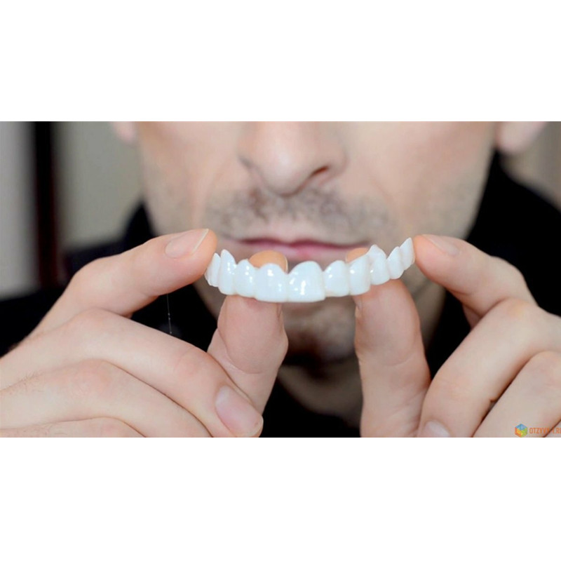 Weiche Silikon Gel Dental Oral – Teeth Whitening Moulds Bewertung und Preis