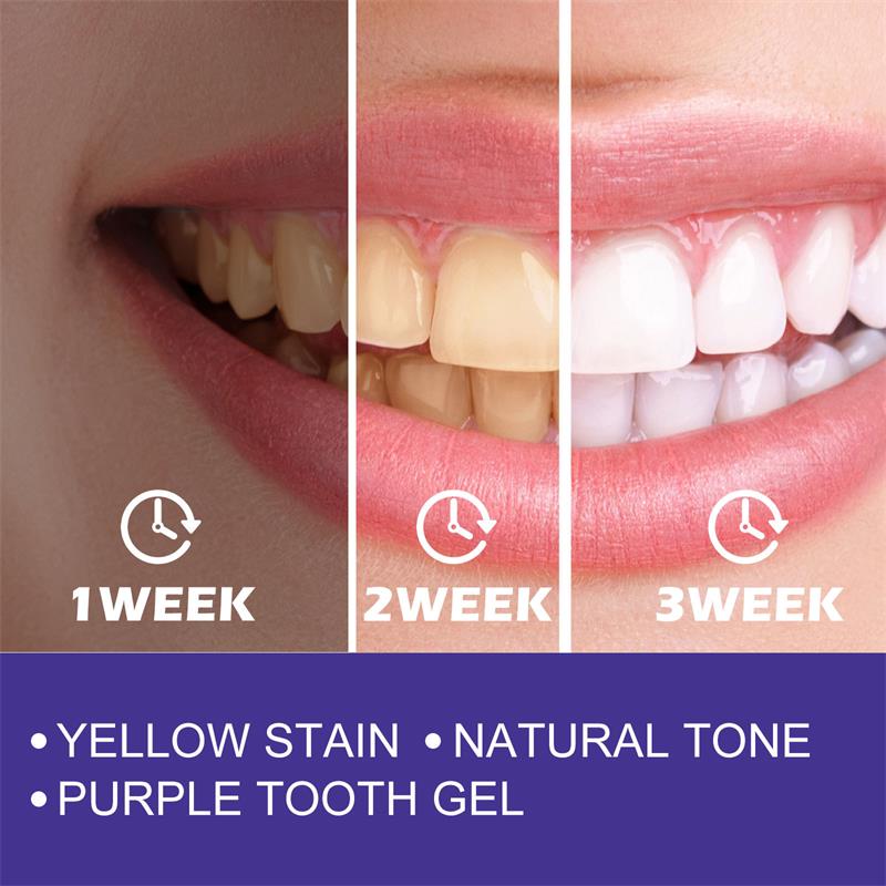 1 stücke Zahn reinigung White  – Teeth Whitening Korea Bewertung und Preis
