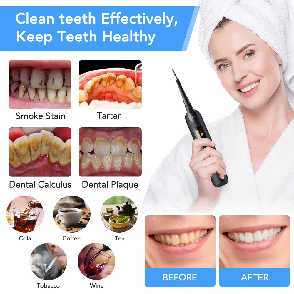 Elektrische Dental Scaler Zahn – Teeth Whitening Or Tooth Whitening Bewertung und Preis