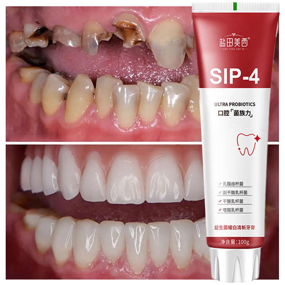 100g Sip-4 Probiotische Zahnau – Teeth Whitening Best Bewertung und Preis