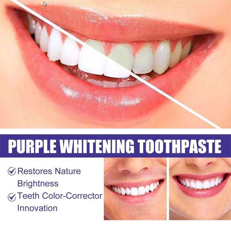 Zahnreinigungs- und Aufhellung – Teeth Whitening Korea Bewertung und Preis