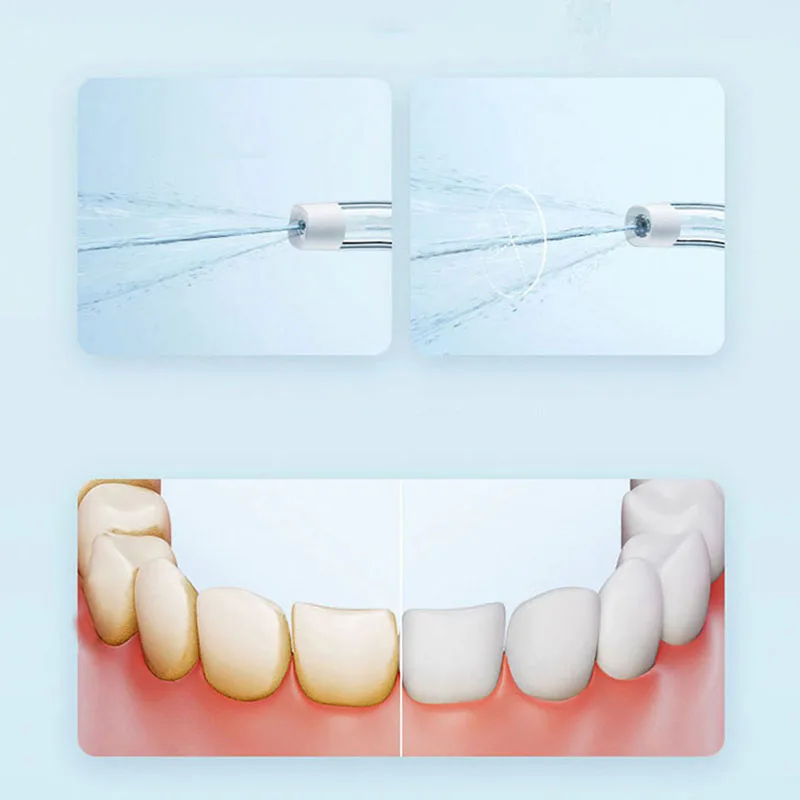 Xiaomi Tragbarer Mundduschen-I – Teeth Whitening Or Tooth Whitening Bewertung und Preis