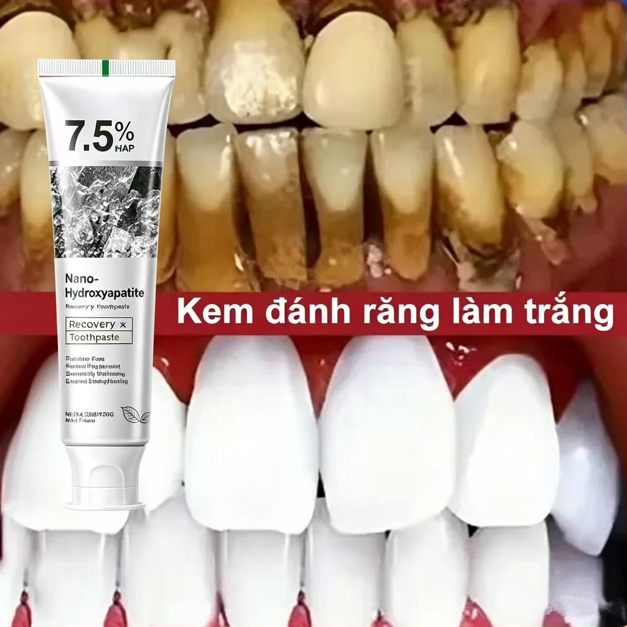 7,5% Hydroxyapatit Probiotisch – Teeth Whitening Best Bewertung und Preis