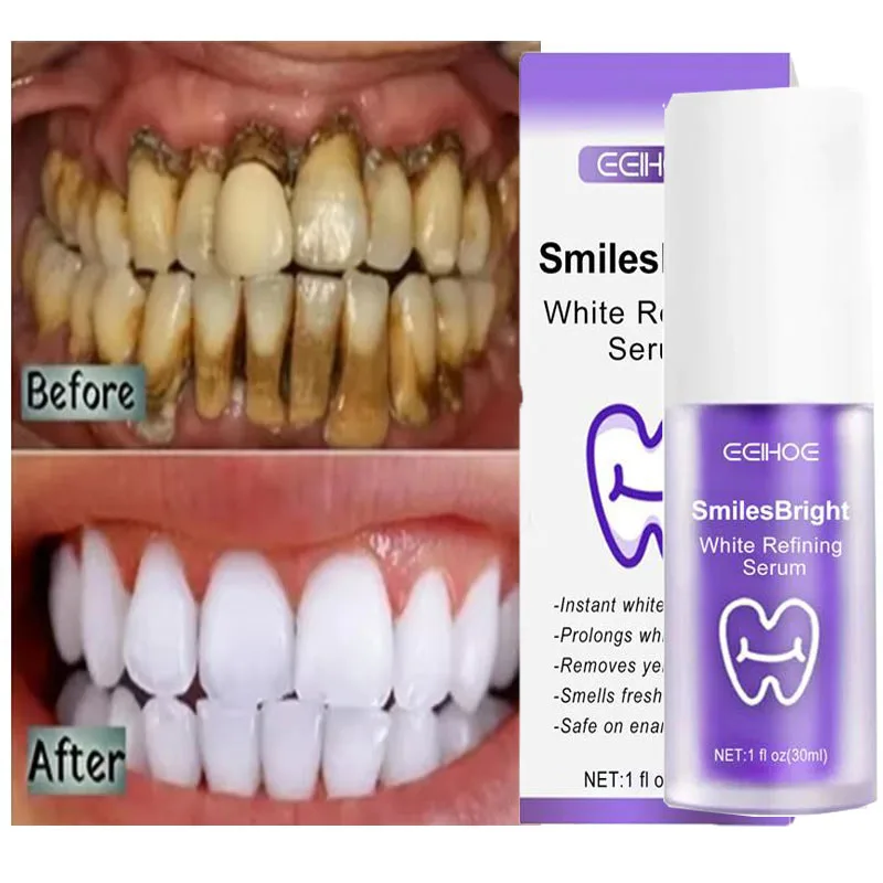 Zahnreinigung, Aufhellung, Zah – Teeth Whitening Korea Bewertung und Preis